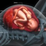 Placental weakness in pregnant women | Causes and prevention